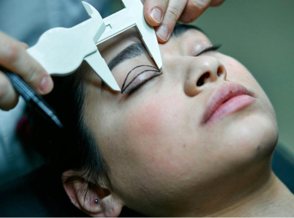 Žena tokom operacije za podočnjake